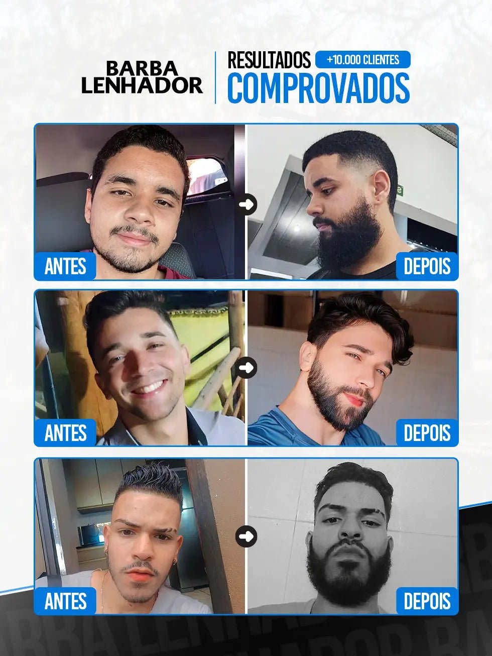 Minoxidil 5% para Barba e Cabelo com Conta-Gotas 2 Minoxidil 5% para Barba e Cabelo com Conta-Gotas - Imagem 2