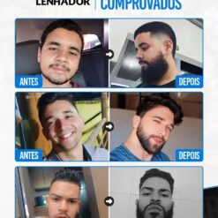 BTV - Site Oficial minoxidil kirkland 5 ativador de crescimento major 1232706