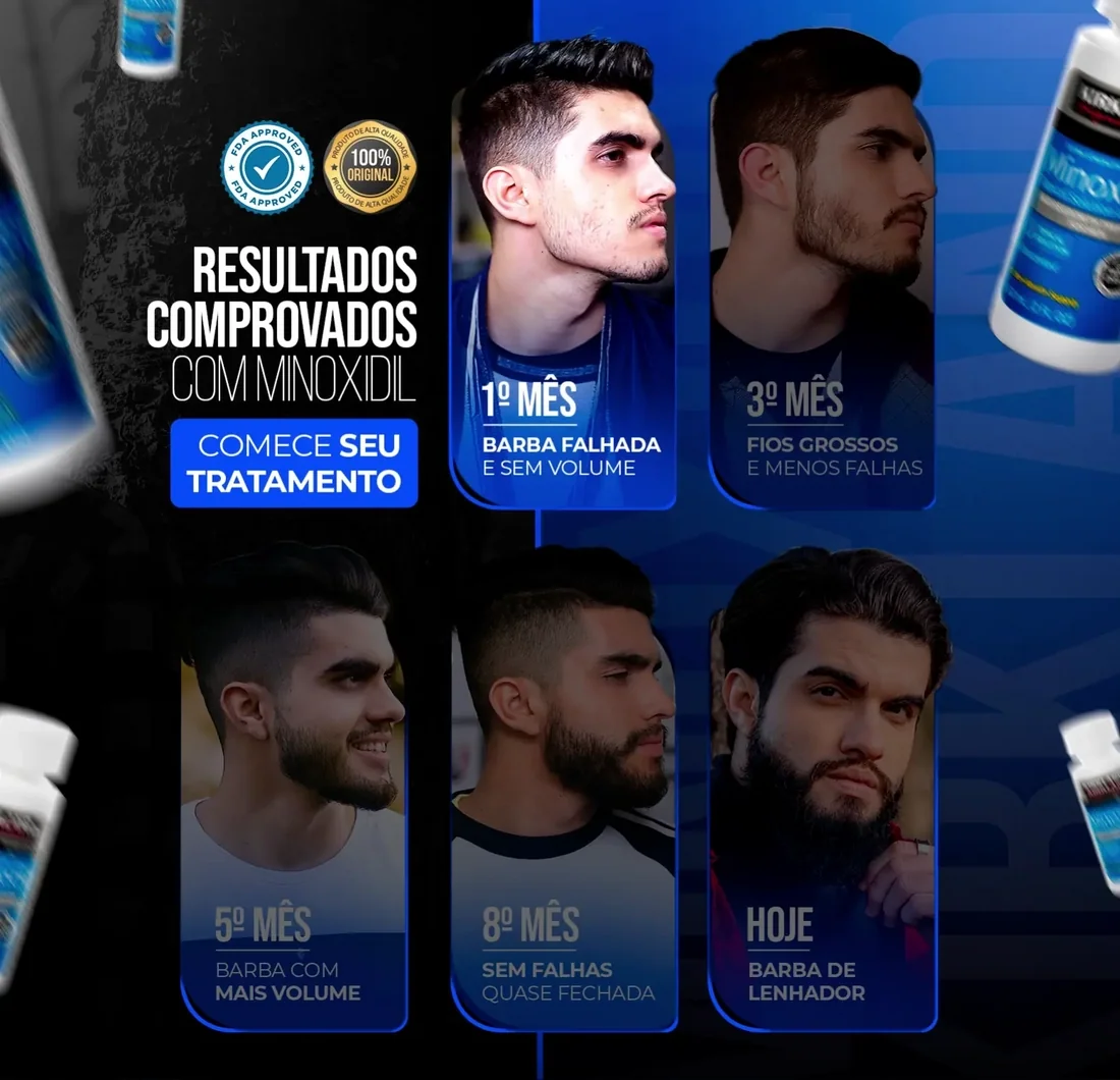 BTV - Site Oficial barba lenhador andrew evolucoes mobile att